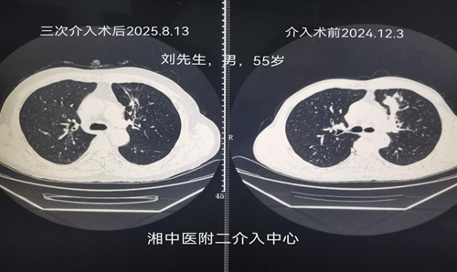 湖南率先开设细胞和基因治疗门诊,精准医疗迈入新纪元(图1) 湖南率先开设细胞和基因治疗门诊,精准医疗迈入新纪元(图1)